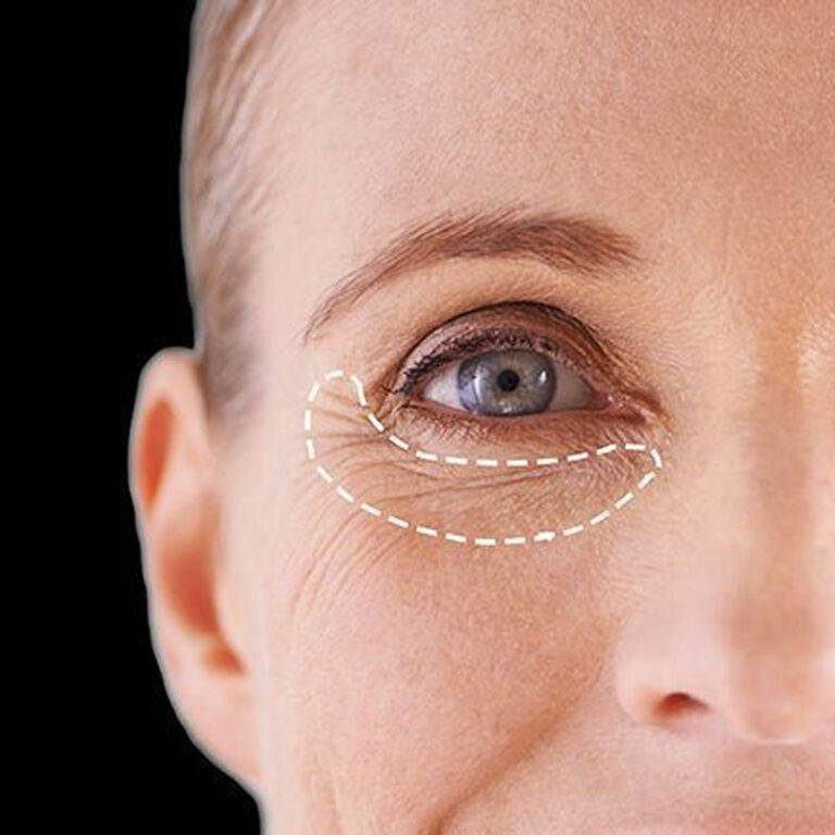 Peptide for Anti-Aging – Youthful Skin with Only Peptide