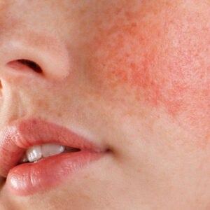 Peptides Skin Care routine for glowing and youthful skin