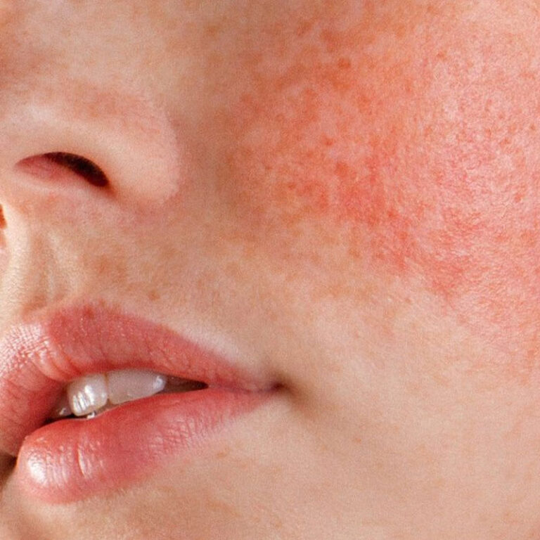 Peptides Skin Care routine for glowing and youthful skin