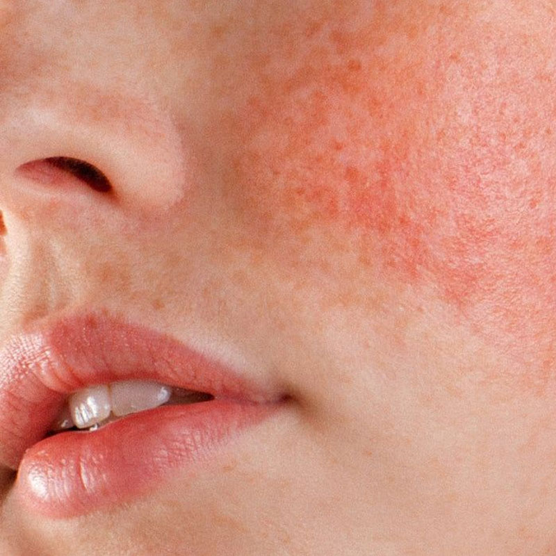 Peptides Skin Care routine for glowing and youthful skin