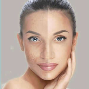 Winter skin care tips for glowing and hydrated skin with peptides – Only Peptide