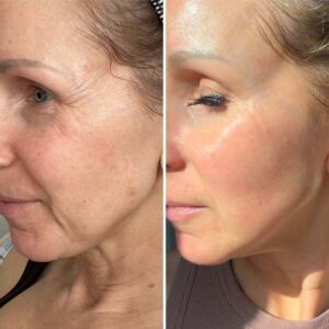 Best Anti-Aging Peptide for Youthful Skin and Longevity