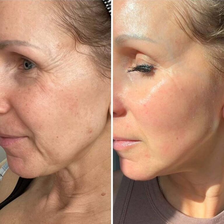 Best Anti-Aging Peptide for Youthful Skin and Longevity